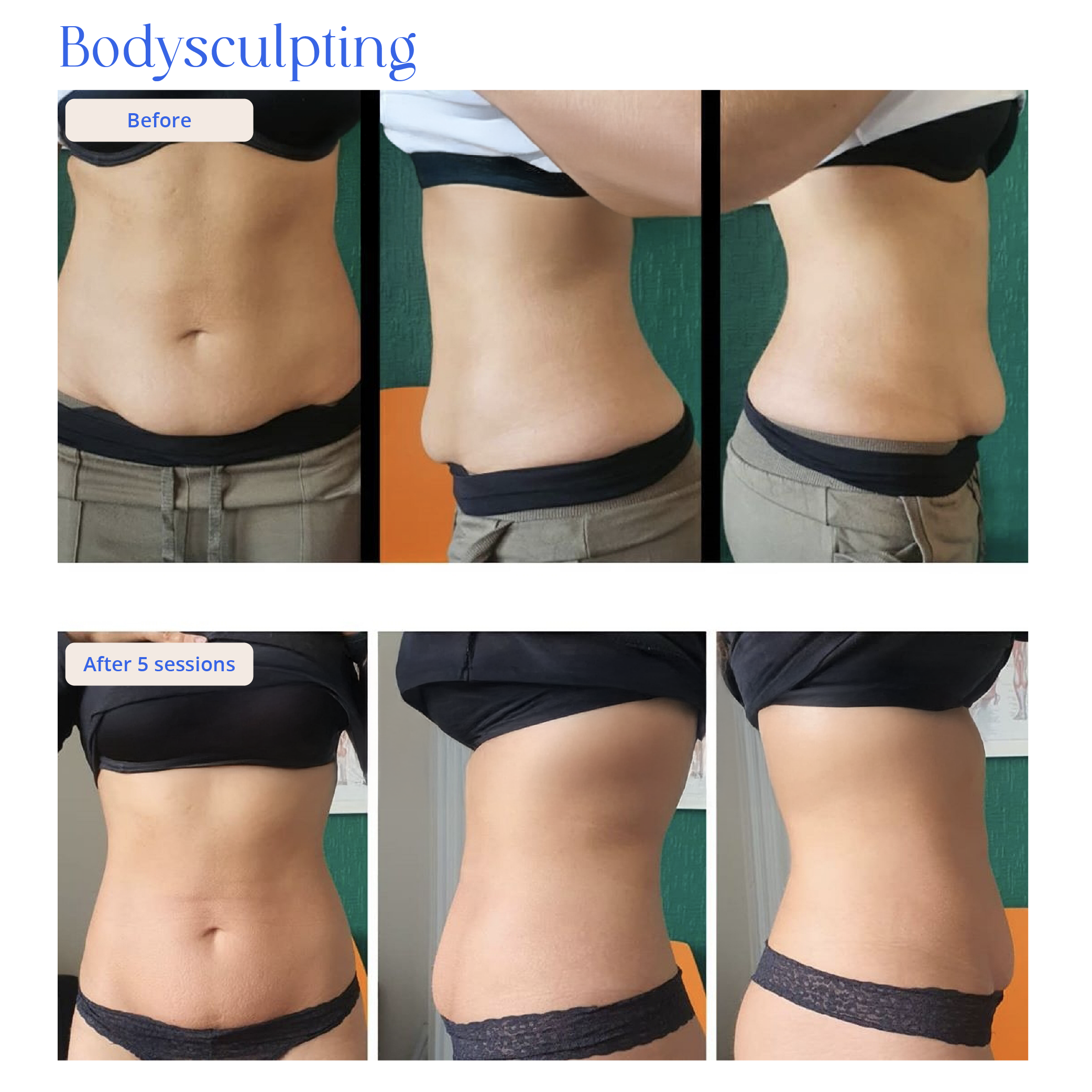 Before and After Result 1