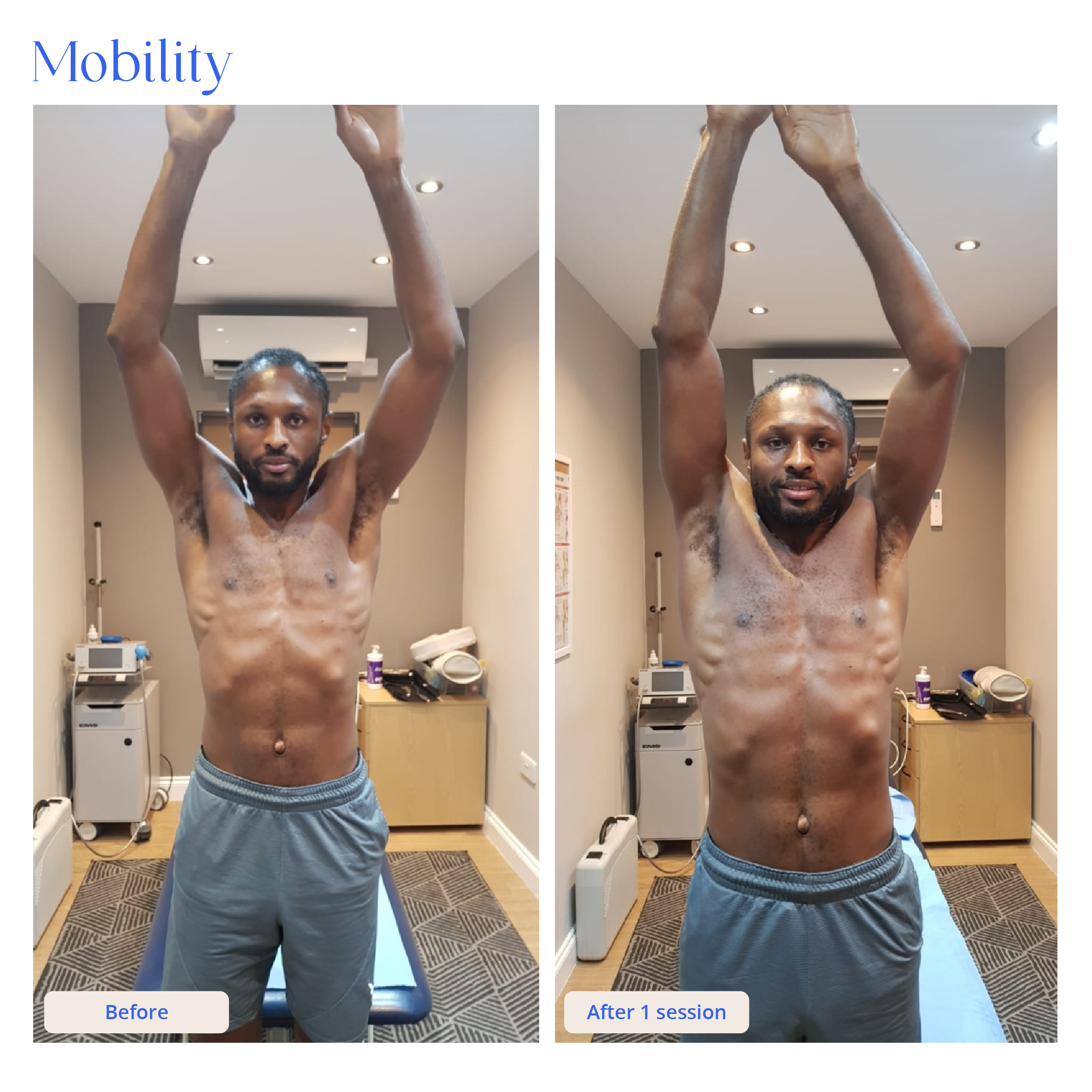 Before and After Result 13