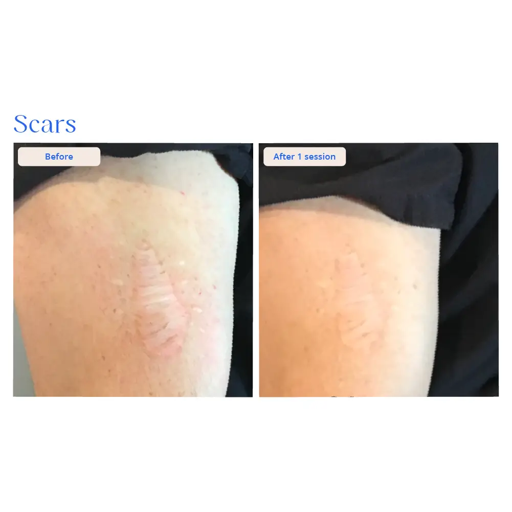 Before and After Result 15