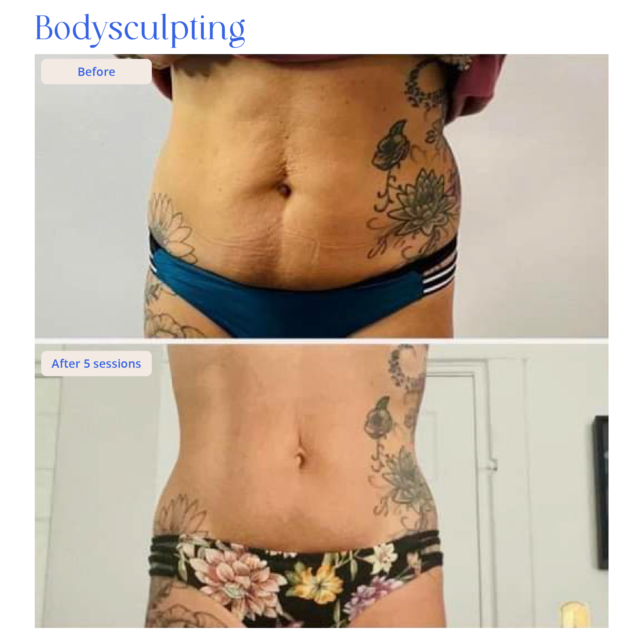 Before and After Result 3